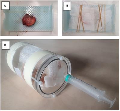 Feasibility of an MR-based digital specimen for tongue cancer resection specimens: a novel approach for margin evaluation